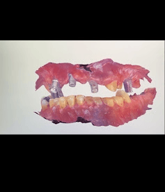 Dental Scan 1