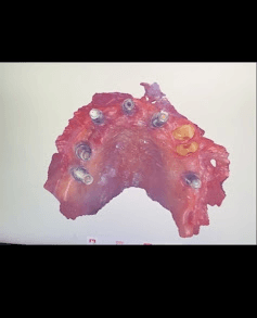 Dental Scan 2