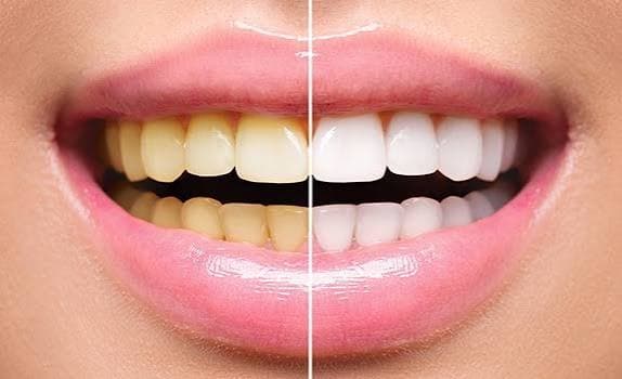 Dental Care